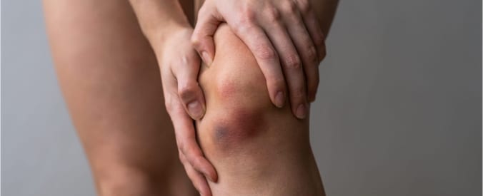 photo of injured knee